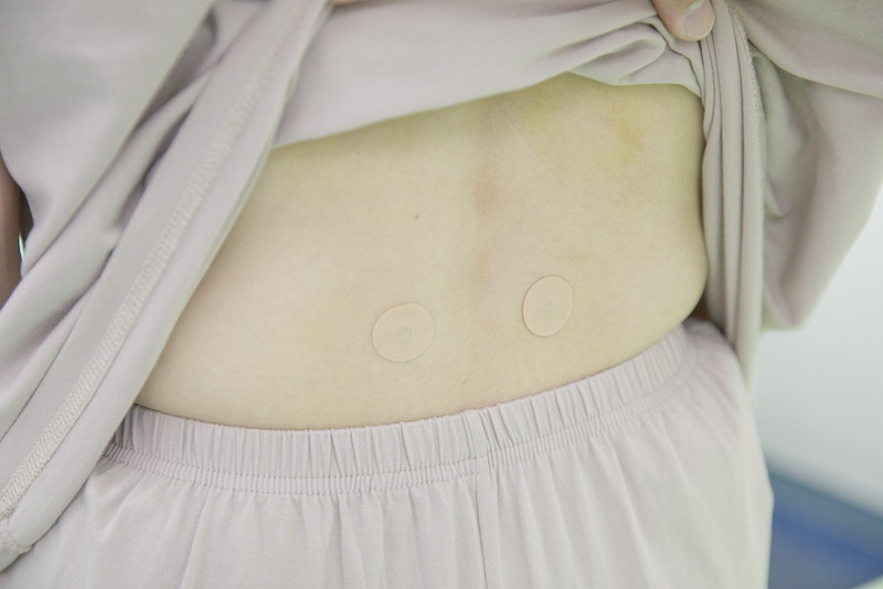 経穴へのアプローチ